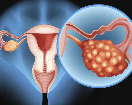 请帮我在重庆找人代怀试管婴儿的费用,三亚有做试管婴儿的医院吗?